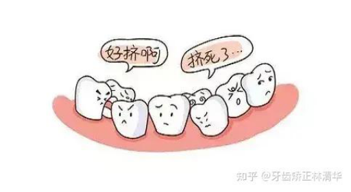 铸瓷桩的特点（铸瓷拆了之后牙是什么样的）